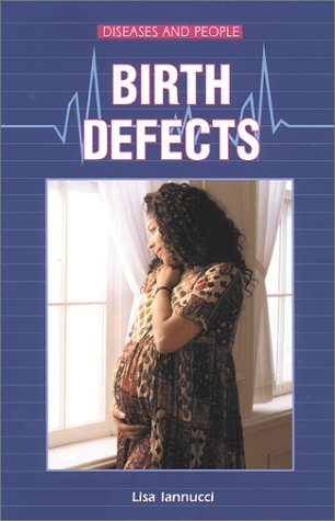 Beispielbild fr Birth Defects zum Verkauf von Better World Books