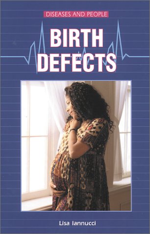 Stock image for Birth Defects for sale by Better World Books
