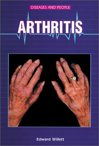Imagen de archivo de Arthritis a la venta por Better World Books