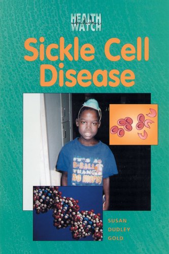 Beispielbild fr Sickle Cell Disease zum Verkauf von Better World Books