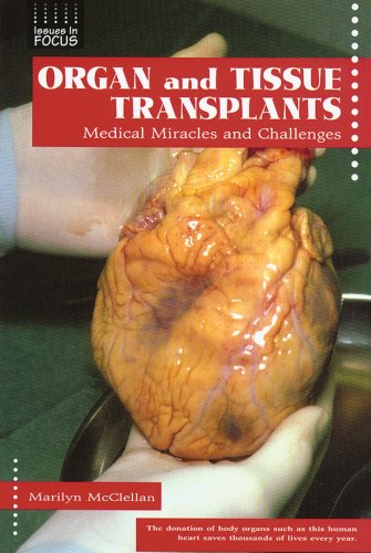 Organ and Tissue Transplants: Medical Miracles and Challenges - McClellan, Marilyn