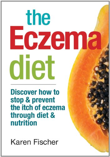 Stock image for The Eczema Diet : Discover How to Stop and Prevent the Itch of Eczema Through Diet and Nutrition for sale by Better World Books