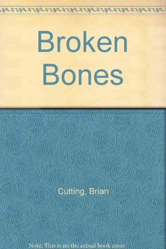 9780780202580: Broken Bones