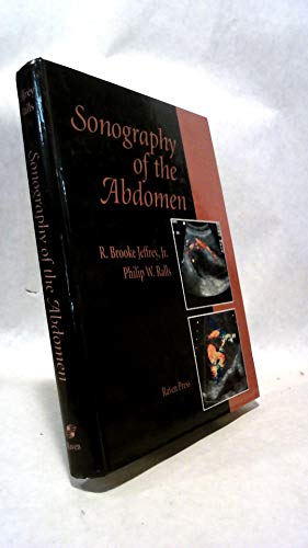 Beispielbild fr Sonography of the Abdomen zum Verkauf von HPB-Red