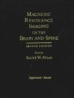 Imagen de archivo de Magnetic Resonance Imaging of the Brain and Spine a la venta por Wonder Book