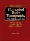 9780781702911: Computed Body Tomography With Mri Correlation