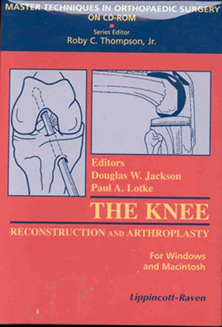 9780781714174: Reconstructive Surgery AND Knee Arthroplasty:oaWindows/Macintosh