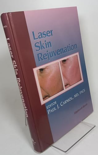 9780781715614: Laser Skin Rejuvenation