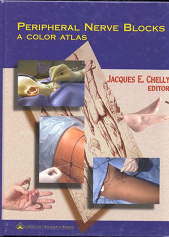 9780781716260: Peripheral Nerve Blocks: A Color Atlas