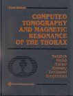 9780781716604: Computed Tomography and Magnetic Resonance of the Thorax