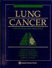 Stock image for Lung Cancer : Principles and Practice for sale by Better World Books: West