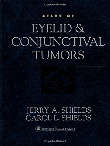 Imagen de archivo de Atlas of Eyelid and Conjunctival Tumors a la venta por HPB-Red