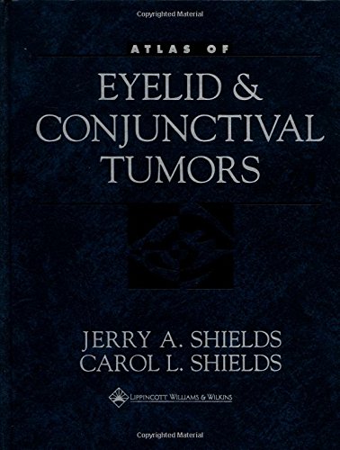 Stock image for Atlas of Eyelid and Conjunctival Tumors for sale by HPB-Red