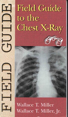 Beispielbild fr Field Guide to the Chest X-Ray (Field Guide (Philadelphia, Pa.).) zum Verkauf von BooksRun