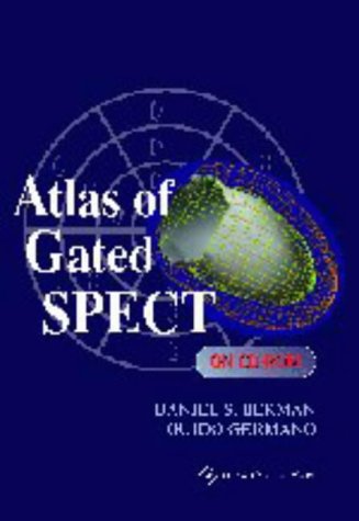 9780781720496: Atlas of Gated SPECT (Media)