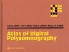 Stock image for Atlas of Digital Polysomnography for sale by HPB-Red
