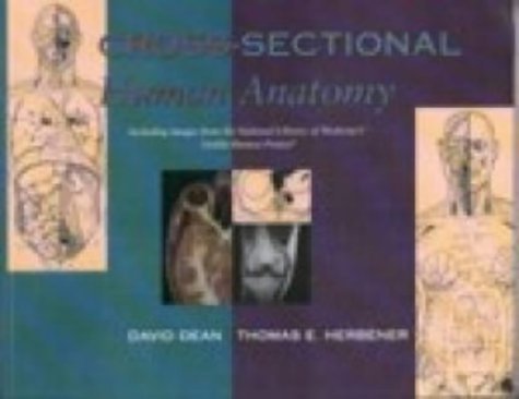 Cross-sectional Human Anatomy: Human Anatomy (9780781726740) by David Dean; Thomas E Herbener