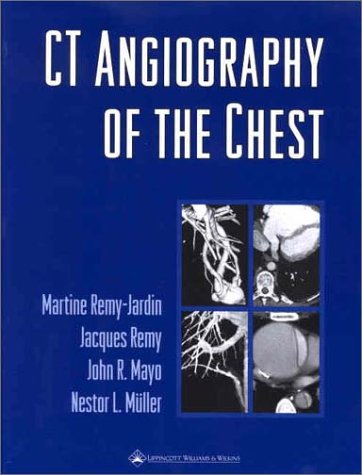 Imagen de archivo de CT Angiography of the Chest a la venta por Better World Books Ltd