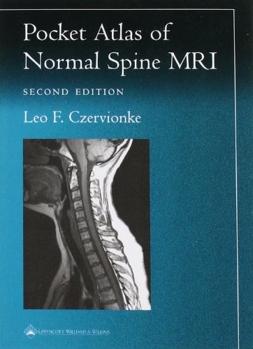 Stock image for Pocket Atlas of Spinal MRI (Radiology Pocket Atlas Series) for sale by BooksRun