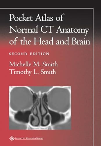 Pocket Atlas of Normal CT Anatomy of the Head and Brain (Radiology Pocket Atlas Series) (9780781729499) by Smith MD, Michelle M.; Smith MD MPH, Timothy L.