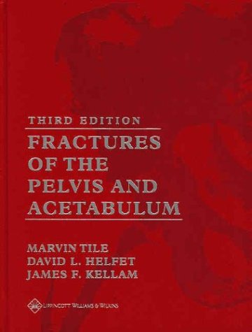 Stock image for Fractures of the Pelvis and Acetabulum for sale by GF Books, Inc.