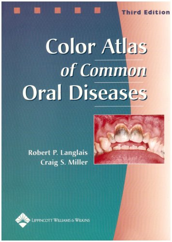 Imagen de archivo de Color Atlas of Common Oral Diseases a la venta por SecondSale