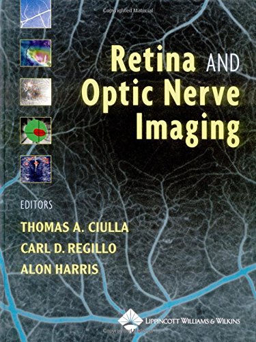 Stock image for Retina and Optic Nerve Imaging for sale by HPB-Red