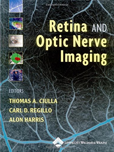 Stock image for Retina and Optic Nerve Imaging for sale by Irish Booksellers