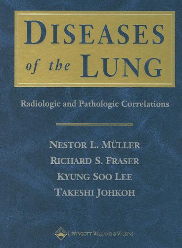 Stock image for Diseases of the Lung: Radiologic and Pathologic Correlations for sale by Reuseabook