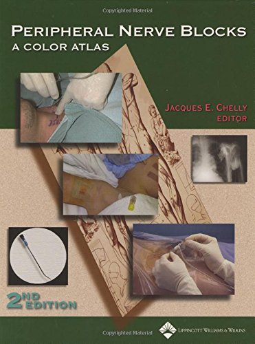 9780781736404: Peripheral Nerve Blocks: A Color Atlas