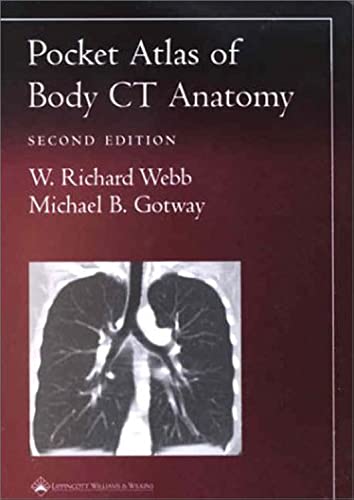 9780781736633: Pocket Atlas of Body Ct Anatomy