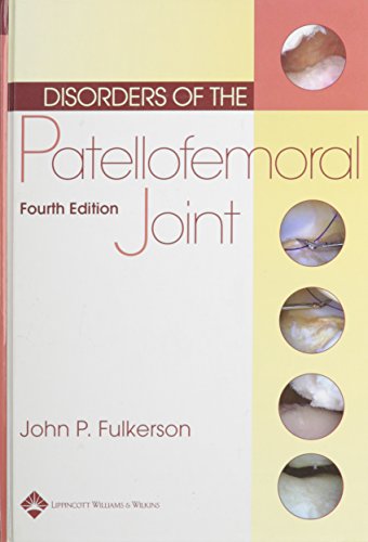 Imagen de archivo de Disorders of the Patellofemoral Joint a la venta por ZBK Books