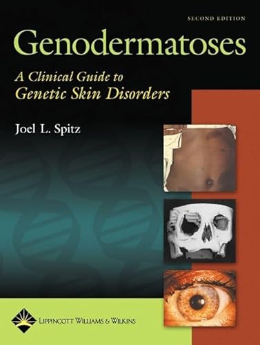 Stock image for Genodermatoses: A Clinical Guide to Genetic Skin Disorders for sale by Scubibooks