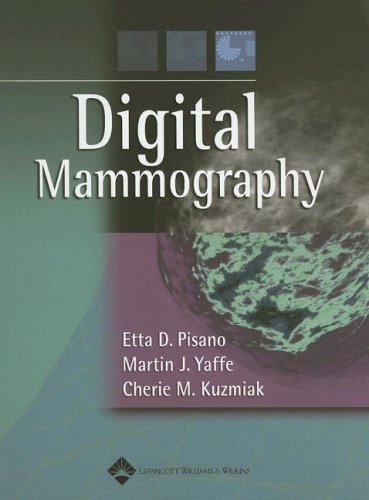 Stock image for Digital Mammography for sale by Better World Books