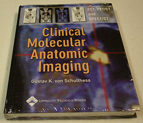 Imagen de archivo de Clinical Molecular Anatomic Imaging: PET, PET/CT, and SPECT/CT a la venta por More Than Words