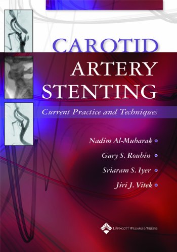 Stock image for Carotid Artery Stenting: Current Practice and Techniques for sale by SecondSale
