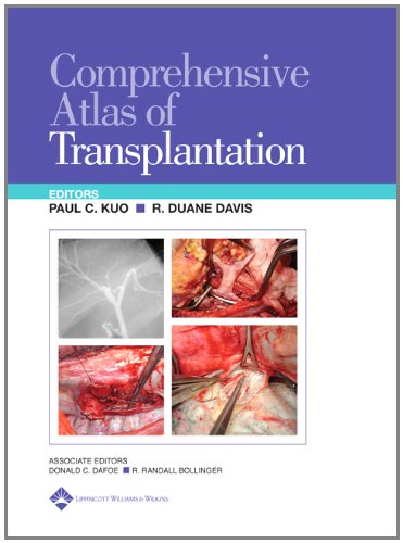 Stock image for Comprehensive Atlas of Organ Transplantation for sale by SecondSale