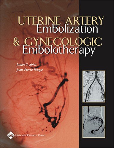 Stock image for Uterine Artery Embolization And Gynecologic Embolotherapy for sale by HPB-Red