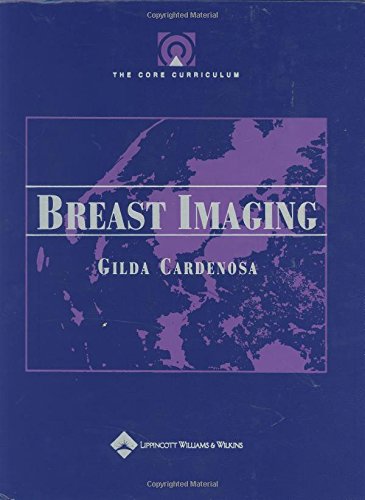 Imagen de archivo de Breast Imaging Core Curriculum (Englisch) Gebundene Ausgabe Gilda Cardenosa (Autor) Introducing a brand-new volume of "The Core Curriculum" - a series of textbooks that are indispensable as both guides for radiology residents' rotations and study tools for written boards or recertification exams. Each volume of "The Core Curriculum" examines one key area - such as ultrasound, neuroradiology, musculoskeletal imaging, cardiopulmonary imaging, breast imaging, head-and-neck imaging, or interventional radiology - and focuses on the essential information readers need to do well on the boards. The user-friendly presentation includes chapter outlines, tables, bulleted lists, boxed text, margin notes, key review points, hundreds of illustrations, and an easy-to-follow layout. a la venta por BUCHSERVICE / ANTIQUARIAT Lars Lutzer