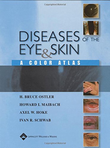 Beispielbild fr Diseases of the Eye and Skin : A Color Atlas zum Verkauf von Better World Books