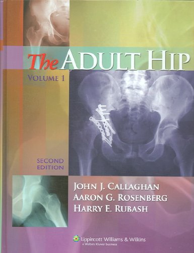 Beispielbild fr The Adult Hip, in two volumes, Vol.2 zum Verkauf von CSG Onlinebuch GMBH