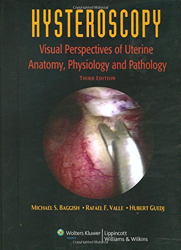 Imagen de archivo de Hysteroscopy: Visual Perspectives of Uterine Anatomy, Physiology and Pathology Baggish, Michael S.; Valle, Rafael F. and Guedj, Hubert a la venta por GridFreed