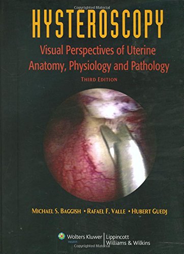 Stock image for Hysteroscopy: Visual Perspectives of Uterine Anatomy, Physiology and Pathology Baggish, Michael S.; Valle, Rafael F. and Guedj, Hubert for sale by GridFreed