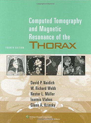 Stock image for Computed Tomography and Magnetic Resonance of the Thorax for sale by Better World Books