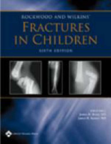 Stock image for Rockwood and Wilkins' Fractures in Children: Rockwood, Green, and Wilkins' Fractures (Not Sold as a Volume Set) for sale by SecondSale