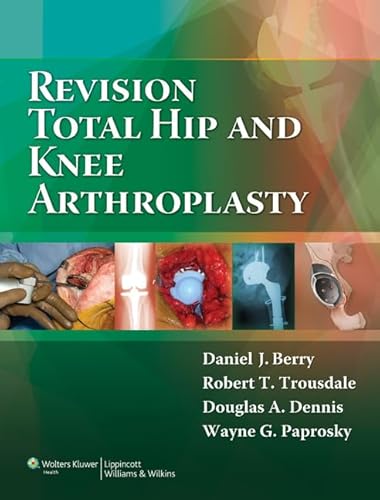 Stock image for Revision Total Hip and Knee Arthroplasty for sale by Scubibooks