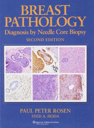 Beispielbild fr Breast Pathology : Diagnosis by Needle Core Biopsy zum Verkauf von Better World Books