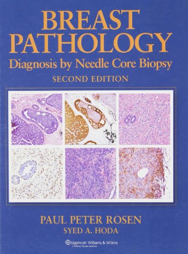 9780781760942: Breast Pathology: Diagnosis by Needle Core Biopsy