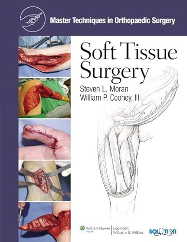 Stock image for Soft Tissue Surgery (Master Techniques in Orthopaedic Surgery) for sale by BOOKWEST
