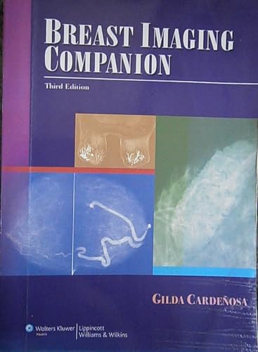 Stock image for Breast Imaging Companion (Cardenosa, Breast Imaging Companion) for sale by Books of the Smoky Mountains